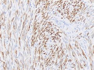 3255B | Control Slides:Immunopathology; Desmin